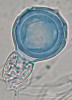 Pohlavní orgány plísně olšové (Phytophthora alni). Blíže v textu. Foto K. Černý