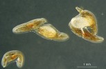 Různá stadia klíčení semen  americké orchideje Duckeella alticola. Vlevo nevyklíčené semeno. Uprostřed klíčící semeno, jehož zvětšující se embryo protrhlo osemení. Vpravo vyklíčené semeno, ze kterého vyrůstá protokorm s prvními vlásky (rhizoidy). Foto J. Ponert