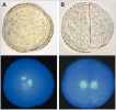 Pylová mitóza I u huseníčku rolního (Arabidopsis thaliana). A – kontrolní rostliny, B – mutant gemini pollen 1, jehož mikrospory se dělí stejnoměrně, takže namísto pylových zrn vznikne  dvojice buněk. Snímky ze světelného (nahoře) a fluorescenčního mikroskopu.  Foto S. Park a D. Twell (Park a kol. 1998), s laskavým svolením