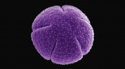 Zralé pylové zrno máku (Papaver) pod skenovacím elektronovým mikroskopem. Počítačově kolorováno. Foto D. Honys