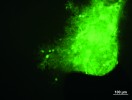 Mikrofotografie kůry mozečku 177 dnů staré myši Lurcher 10 týdnů po transplantaci embryonální nervové tkáně ve formě suspenze buněk odebrané z mozečku 12denního embrya GFP myši. V zobrazení fluorescenčním mikroskopem vidíme zeleně fluoreskující transplantát, na jehož levém okraji se nacházejí Purkyňovy buňky s již vyvinutým typickým dendritickým větvením. Snímky J. Cendelín, pokud není uvedeno jinak