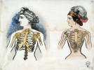 Deformace ženského těla způsobená těsným šněrováním. Londýn 1862. Ze sbírek,  archivu a knižního fondu Národního muzea – Náprstkova muzea asijských, afrických a amerických kultur