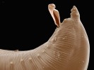 Samec škrkavky T. canis s vysunutou spikulou, sloužící při páření. Foto J. Bulantová
