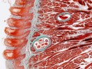 Histologický řez jazykem experimentálně nakaženého potkana – ve svalovině jsou patrné larvy svalovce stočeného (Trichinella spiralis) opouzdřené  kolagenní kapsulí (zeleně). Foto J. Bulantová
