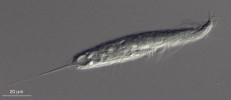 Příklady obligátně anaerobních eukaryot. Mořský anaerobní nálevník Muranothrix felix (Sar: Alveolata: Ciliophora) byl popsán v r. 2023 a je jedním z pouhých čtyř druhů třídy Muranotrichea, jejíž první zástupce byl objeven teprve v r. 2020. Foto D. Méndez-Sánchez 