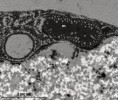 Příklady vodík produkujících mitochondrií (m, hydrogenosomů) obligátně anaerobních eukaryot, jak jsou vidět v transmisním elektronovém mikroskopu. Mitochondrie dosud nepopsaného druhu rodu Blastocystis (Sar: Stramenopiles) ze střeva suchozemských želv z třídy Oligohymenophorea mají dosud zachovány kristy. Na obrázku jsou vidět i některé jiné struktury, např.  vakuola (v), která téměř vyplňuje buňku Blastocystis. Foto I. Čepička