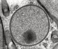 Příklady vodík produkujících mitochondrií (m, hydrogenosomů) obligátně anaerobních eukaryot, jak jsou vidět v transmisním elektronovém mikroskopu. Mitochondrie mořské měňavky Anaeramoeba flamelloides (Metamonada: Anaeramoebae) kristy ztratily. Foto I. Čepička