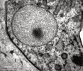 Příklady vodík produkujících mitochondrií (m, hydrogenosomů) obligátně anaerobních eukaryot, jak jsou vidět v transmisním elektronovém mikroskopu. Mitochondrie mořských bičíkovců Velundella trypanoides (Discoba: Jakobida) kristy ztratily.  Foto I. Čepička