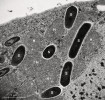  Sladkovodní anaerobní nálevník  Anaerocyclidium helenae z podtřídy  Scuticociliatia s metanogenními endosymbionty (S), kteří jsou v úzkém vztahu  s hydrogenosomy (H). Snímek z transmisního elektronového mikroskopu.   Foto K. Koštířová 