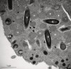  Sladkovodní anaerobní nálevník  Bothrostoma undulans z řádu Metopida  s metanogenními endosymbionty (S),  opět v úzkém vztahu s hydrogenosomy  (H). Jsou vidět i kortikální granula (KG).   Snímek z transmisního elektronového  mikroskopu. Foto D. Méndez-Sánchez