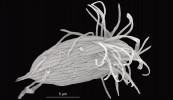  Mořský anaerobní nálevník Maricyclidium commune pokrytý symbionty,  pravděpodobně síran redukujícími   bakteriemi. Snímek ze skenovacího  elektronového mikroskopu. Foto K. Koštířová 