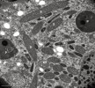  Průřez cytoplazmou nálevníka  Legendrea loyezae z třídy Litostomatea.  Lze rozeznat všechny čtyři druhy   symbiontů (MB – Methanobacterium,   MT – Methanothrix, S – „Syntrophilus“,  X – „Xociella“) a anaerobní mitochondrie, které neprodukují vodík (MR).   Výrazné jsou i potravní vakuoly (P).   Foto O. Pomahač
