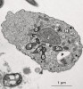 Buňka měňavky druhu Anaeramoeba pumila. Prokaryotičtí symbionti (S)  nejsou syntrofní a nejsou asociováni  s hydrogenosomy (H). Je vidět i jádro (J),  mikrotubulární organizační centrum (M)  a potravní vakuola (P). Snímek z transmisního elektronového mikroskopu.  Foto M. Pavlátová 