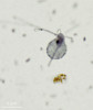 Příklady obligátně anaerobních eukaryot. Pimpavicka limacoides (Metamonada: Parabasalia) je mořská a brakická volně žijící trichomonáda. Většina trichomonád obývá střeva nebo jiné vnitřní orgány živočichů, ale pimpavičky jsou volně žijící. Byly objeveny v r. 2022 a dnes představují samostatnou třídu kmene Parabasalia. Barveno protargolem.  Foto I. Čepička