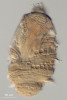 Příklady obligátně anaerobních eukaryot. Nálevník Troglodytella gorillae (Sar: Alveolata: Ciliophora) patří do třídy Litostomatea a najdeme ho v tlustém střevě goril, kde se možná podílí na trávení potravy.  Foto M. Kotyk 