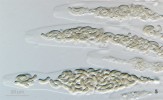 Polysporická vřecka polštářnatky dubové (Diatrypella quercina) se zmnoženými uzenkovitými askosporami. Foto O. Koukol