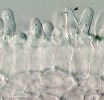 Vřecka kadeřavky broskvoňové (Taphrina deformans), jedno vyprázdněné (viz šipka) na povrchu listu broskvoně. Foto O. Koukol