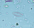 Příklady schránek (valv) druhů rozsivek, které v Komořanském jezeře dominovaly v různých obdobích jeho historie. Pozdní glaciál – Staurosira venter. Snímky z optického mikroskopu, délka měřítka 5 μm. Foto A. Tichá