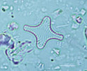 Příklady schránek (valv) druhů rozsivek, které v Komořanském jezeře dominovaly v různých obdobích jeho historie. Spodní a střední holocén – S. construens. Snímky z optického mikroskopu, délka měřítka 5 μm. Foto A. Tichá