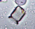 Příklady schránek (valv) druhů rozsivek, které v Komořanském jezeře dominovaly v různých obdobích jeho historie. Svrchní holocén – Aulacoseira ambigua. Snímky z optického mikroskopu, délka měřítka 5 μm. Foto A. Tichá