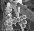 Chaetocladium brefeldii (Mucoromycota) – detail sporangiol (jednosporických kulovitých sporangií). Snímek ze skenovacího elektronového mikroskopu. Foto A. Nováková