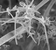 Chaetocladium brefeldii (Mucoromycota) – sporangioly se vytvářejí na větvích sporoforu zakončených dlouhými sterilními ostny. Snímek ze skenovacího elektronového mikroskopu. Foto A. Nováková