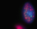 Mixotrofní nálevník Tetrahymena sp. z pasti bublinatky U. reflexa pod epifluorescenčním mikroskopem (zvětšeno 1 000×). Endosymbiotické zelené řasy zoochlorely svítí fialově, patrné jsou  také fluorescenčně značené bakterie  (svítí zeleně) v potravních vakuolách. Foto K. Šimek