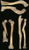 Ukázky zlomenin u jedinců z velkomoravských Mikulčic: nahoře pravé klíční kosti (na snímku ta spodní), dole vlevo  pravé stehenní kosti a vpravo obou kostí předloktí. Foto J. Likovský 
