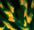 Buňky v kolonii zlativky rodu Dinobryon s pohlcenými fluorescenčně značenými bakteriemi, což jsou žluté  fluoreskující malé buňky, které se přidávají v malé proporci do přírodního  bakterioplanktonu jako „stopovač“  rychlosti příjmu bakteriálních buněk. Protože jde o mixotrofní prvoky, tedy mikroorganismy kombinující příjem  partikulované potravy – bakterie – a současně fotosyntézu podobně jako řasy,  při použití vlnové délky 530 nm v epifluo­rescenčním mikroskopu v pozadí červeně prosvítají i chloroplasty uložené v cytoplazmě buněk těchto prvoků. Foto K. Šimek