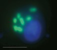 Buňky heterotrofních bičíkovců (kulatý modrý objekt v buňkách je jádro obarvené fluorochromem DAPI, který  se váže na DNA v jádře) s pohlcenými zelenožlutě fluoreskujími buňkami  bakterií hybridizovanými s fluorescenčně značenou RNA-sondou pro rod Limnohabitans. Bílá úsečka představuje délku 5 μm. Foto K. Šimek
