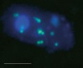 Buňky heterotrofních bičíkovců (kulatý modrý objekt v buňkách je jádro obarvené fluorochromem DAPI, který  se váže na DNA v jádře) s pohlcenými zelenožlutě fluoreskujími buňkami  bakterií hybridizovanými s fluorescenčně značenou RNA-sondou pro třídu Beta­proteobacteria. Bílá úsečka představuje délku 5 μm. Foto K. Šimek