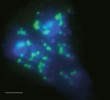 Buňky heterotrofních bičíkovců (kulatý modrý objekt v buňkách je jádro obarvené fluorochromem DAPI, který  se váže na DNA v jádře) s pohlcenými zelenožlutě fluoreskujími buňkami  bakterií hybridizovanými s fluorescenčně značenou RNA-sondou pro rod Limnohabitans. Bílá úsečka představuje délku 5 μm. Foto K. Šimek