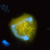Pelagovorticella natans – všežravý nálevník, konzumující potravní částice od velikosti bakterií do asi 5–6 μm. Vyznačuje se zejména vysokou rychlostí příjmu bakterií (označené žlutě). Podle: K. Šimek a kol. (2019)