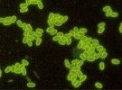 Fluorescenčně označené spory Nosema bombycis, parazita bource  morušového (Bombyx mori). Velikost spor asi 3–4 × 2,5 μm. Foto J. Vávra 