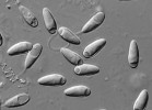 Detail spor mikrosporidie rodu Amblyospora uvolněných z tkání buchanky obecné (Cyclops strenuus). Foto J. Vávra