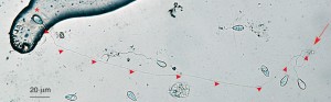 Spora mikrosporidie rodu Amblyospora, parazita buchanek a komárů, dlouhá 12 μm s vystřelenou pólovou trubicí o délce více než 300 μm. Uvolněný obsah spory na konci vlákna označuje šipka. Uvnitř neaktivované spory je tato trubice stočena ve 20 závitech. Foto J. Vávra