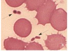 Morová bakterie Yersinia pestis je gramnegativní tyčinka s délkou kolem 2 μm. Na snímku obarvené bakterie v krevním nátěru. Šipky ukazují  bakteriální buňky (nahoře samostatná, dole dělící se buňka). Yersinia se typicky barví výrazněji na pólech. Snímek se svolením Centre for Disease Control (http://phil.cdc.gov/phil/)