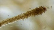 „Nezní to lákavě, ale tato houba  by mohla pomoci nakrmit hladové“  (Bill Gates, 7. června 2014). Z kořene vyrůstají mimokořenová vlákna – hyfy  arbuskulárně mykorhizní houby Rhizo­phagus irregularis – útvary na povrchu kořene jsou spory, které tento běžný druh tvoří v půdě, na povrchu i uvnitř kořenů hostitelských rostlin. Foto J. Bonvin, s laskavým svolením I. Sanderse