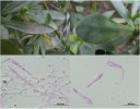 Vlevo nahoře pryšec tupolistý (Euphorbia obtusifolia) se sporulujícím myceliem a plodnicemi palí Podosphaera euphorbiae, vpravo na listu pryšce balzamodárného (E. balsamifera) odlišné symptomy napadení padlím Leveillula taurica (roste převážně uvnitř pletiv), dole konidiofory a protáhlé konidie L. taurica. San Sebastián, La Gomera. Foto M. Sedlářová