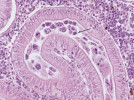 Plasmodia rybomorky Zschokkella pleomorpha (označena šipkou)  ve vnitřním prostoru  (lumenu) ledvinného kanálku  čtverzubce skvrnitého (Tetraodon fluviatilis). Histologický řez  rybí tkáně, barveno  hematoxylinem  a eozinem. Zvětšeno 800×. Foto I. Fiala