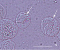Presporogonická vývojová stadia rybomorky Sphaerospora molnari (šipky) v kapru obecném (Cyprinus carpio). Krevní stadium – Nomarského diferen­ciální interferenční kontrast. Primární buňka uvnitř obsahuje buňky sekundární.  Měřítko odpovídá 10 μm. Foto P. Bartošová-Sojková 