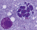 Presporogonická vývojová stadia rybomorky Sphaerospora molnari (šipky) v kapru obecném (Cyprinus carpio). Jaterní stadium (Diff-Quick. Primární buňka uvnitř obsahuje buňky sekundární a uvnitř sekundárních buněk se tvoří buňky terciární. Měřítko 10 μm. Foto P. Bartošová-Sojková 