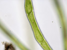 Pohled na protonemata mechu z rodu Dicranella pod mikroskopem – charakteristickým znakem odlišujícím je od vláken zelených řas je šikmá buněčná přepážka. Foto J. Fott