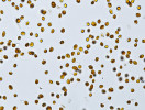  5 až 7	Zástupci fytoplanktonu  Hromnického jezírka: kokální zelená řasa Coccomyxa elongata. Foto J. Fott