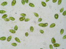 Zástupci fytoplanktonu  Hromnického jezírka: bičíkovec Lepocinclis sp. Foto J. Fott