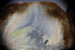 Řez plodnicí bradavnice potoční (Staurothele clopima), kde lze vidět mnohobuněčné výtrusy a fotobionta – zelenou řasu rodu Stichococcus. Foto J. Halda
