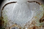 Kryptovka červenavá (Belonia russula) –  svislý průřez plodnicí, která má v průměru 5 mm.  Na řezu jsou viditelné  stěny plodnice (excipulum),  vřecka  se šídlovitými výtrusy rozdělenými přepážkami a podpůrnými buňkami.  Foto J. Halda