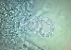 Zduřelé činkovitě tvarované buňky s jemně asperátní buněčnou stěnou u peridiálních hyf s tupým zakončením houby Trichophyton onychocola. Foto A. Čmoková