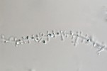 Mikromorfologie morčaty přenášeného druhu Trichophyton benhamiae: nevětvený konidiofor s mikrokonidiemi. Foto A. Čmoková