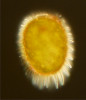 Vzácný taxon ze skupiny  krásnooček – Trachelomonas bituricensis var. lotharingia – s charakteristickou schránkou s robustními trny v optickém mikroskopu. Foto J. Kaštovský